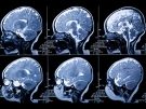 brain scans