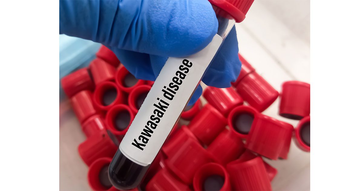 Faster diagnosis and treatment of Kawasaki disease are key to
