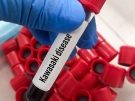 tube marked Kawasaki disease