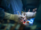 Children's National surgeons perform heart surgery