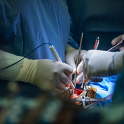 Children's National surgeons perform heart surgery