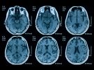 brain scans