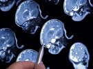 brain scan