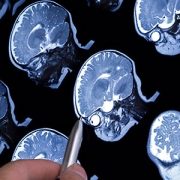 brain scan