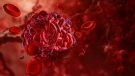 illustration of a blood clot