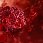 illustration of a blood clot