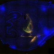 the paralaminar nucleus