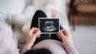 pregnant woman holding sonogram