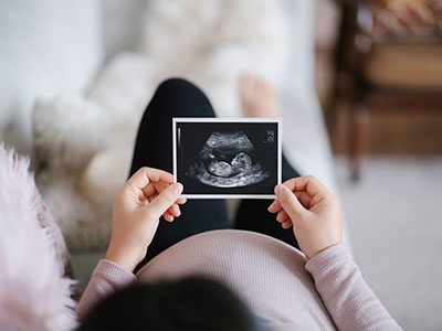 pregnant woman holding sonogram