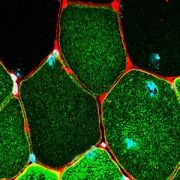 microscope image of muscle cells